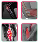 Joelheira de Compressão Ortopédica